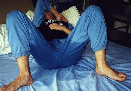 Adult Male Bedwetting 72